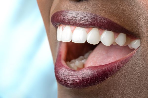 A Full Mouth Reconstruction Often Includes Dental Crowns