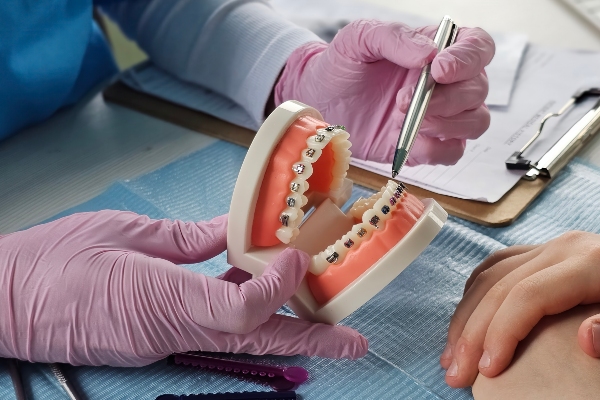 How A Family Dentist Can Tell If Your Child Is A Candidate For Braces