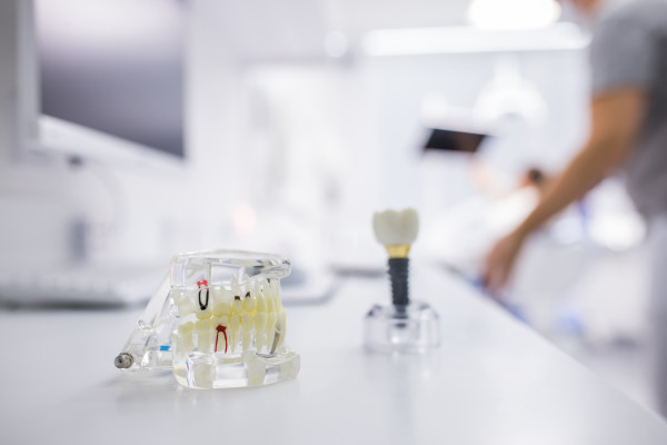 Implant Dentist Services: From Consultation To Final Crown